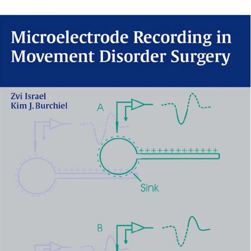 D__Deng Dai Shang Chuan _Microelectrode Recording in Movement Disorder Surgery.nva