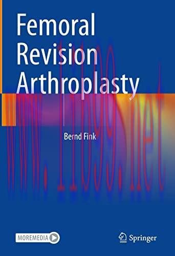 [AME]Femoral Revision Arthroplasty (Original PDF)