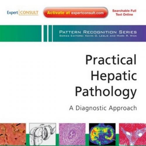 Practical Hepatic Pathology-A Diagnostic Approach A Volume in the Pattern Recognition Series