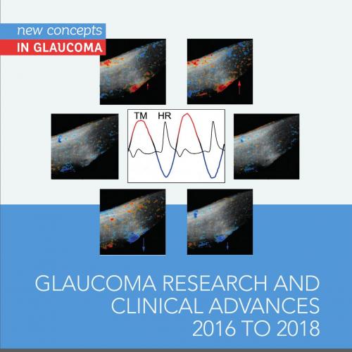 Glaucoma Research and Clinical Advances 2016 to 2018