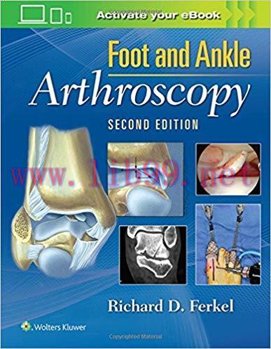 [CHM]Foot and Ankle Arthroscopy, 2nd Edition
