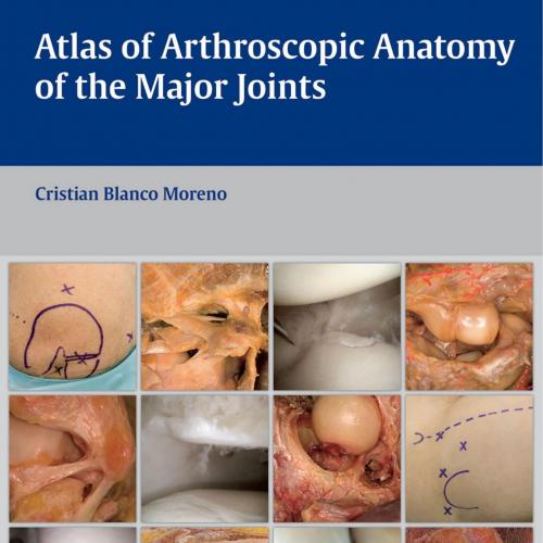 Atlas of Arthroscopic Anatomy of Major Joints
