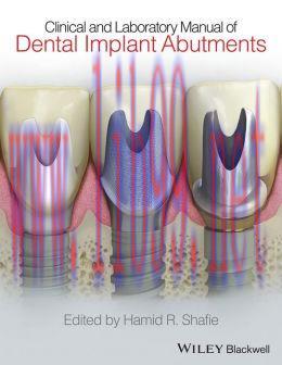 [AME]Clinical and Laboratory Manual of Dental Implant Abutments (Original PDF)