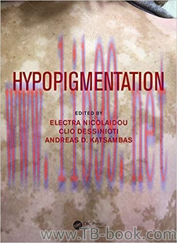 Hypopigmentation 1st Edition by Electra Nicolaidou