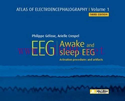[AME]Atlas of Electroencephalography. Awake and sleep EEG. Activation procedures and artifacts ...