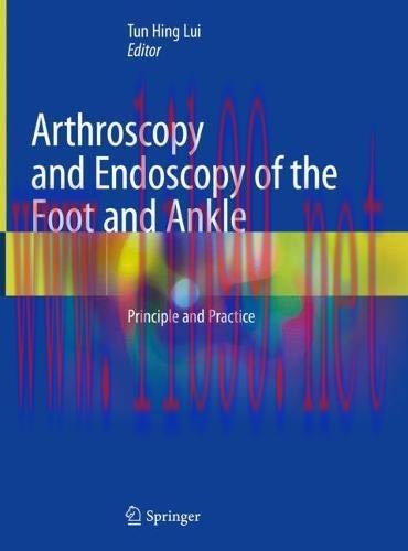 [AME]Arthroscopy and Endoscopy of the Foot and Ankle: Principle and Practice (EPUB)