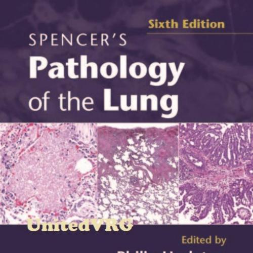 Spencer's Pathology of the Lung, 6E (2013) 2-VOLUME SET