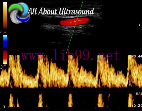 [AME]Ultrasound Physics SPI - Registry Review Course - AllAboutUltrasound (Complete HTML)