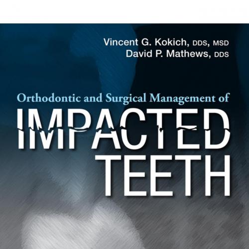 Orthodontic and Surgical Managent of Impacted Teeth