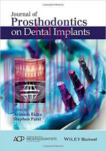 [AME]Journal of Prosthodontics on Dental Implants
