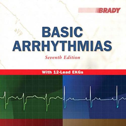 Basic Arrhythmias, 7th Edition