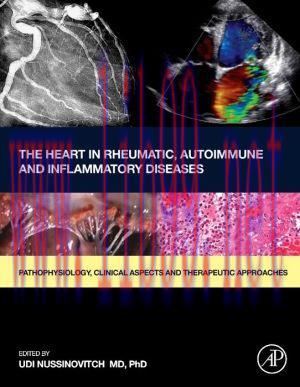 [AME]The Heart in Rheumatic, Autoimmune and Inflammatory Diseases: Pathophysiology, Clinical As...
