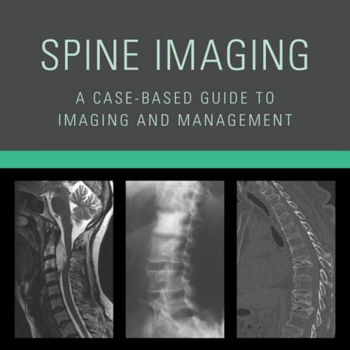 Spine Imaging A Case-Based Guide to Imaging and Management