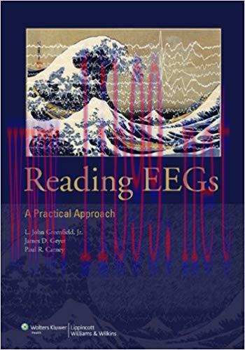 [PDF]Reading EEGs - A PRACTICAL APPROACH+CHM版