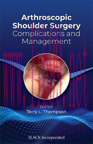 [AME]Arthroscopic Shoulder Surgery: Complications and Management (Original PDF)