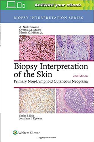 Biopsy Interpretation of the Skin - Primary Non-Lymphoid Cutaneous Neoplasia (Biopsy Interpreta...