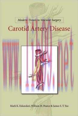 [AME]Modern Trends in Vascular Surgery: Carotid Artery Disease
