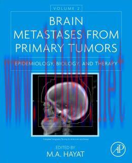 [AME]Brain Metastases from_ Primary Tumors, Volume 2: Epidemiology, Biology, and Therapy