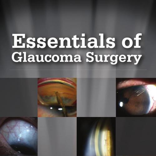 Essentials of Glaucoma Surgery