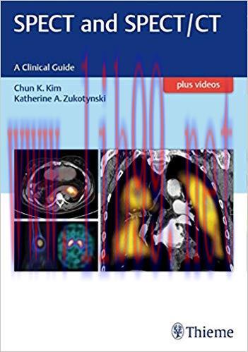 [PDF]SPECT and SPECT-CT A Clinical Guide