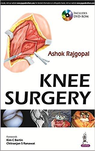 Knee Surgery (Ashok Rajgopal)