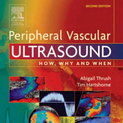 Peripheral Vascular Ultrasound How Why and When 2nd Edition