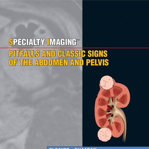 Specialty Imaging Pitfalls and Classic Signs of the Abdomen and Pelvis