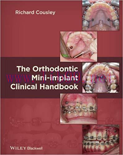 (PDF)The Orthodontic Mini-implant Clinical Handbook 1st Edition