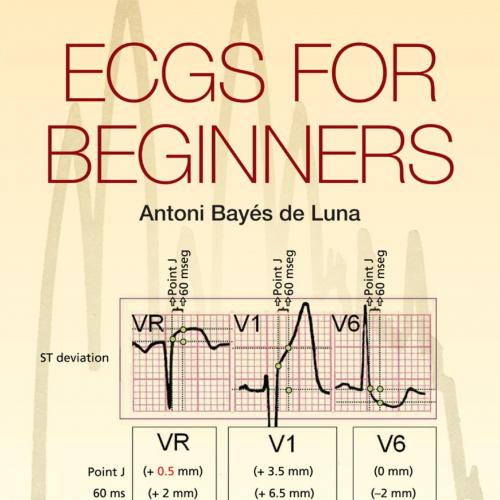 ECGs for Beginners