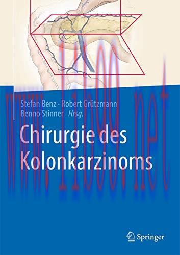 [AME]Chirurgie des Kolonkarzinoms (German Edition) (Original PDF)