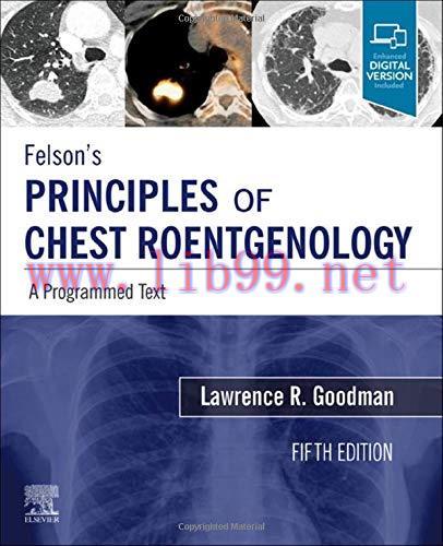 [AME]Felson&rsquo;s Principles of Chest Roentgenology, A Programmed Text: A Programmed Text (PDF+Vide...