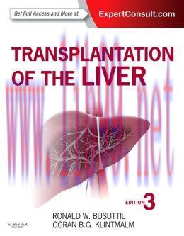 [AME]Transplantation of the Liver, 3rd Edition (ORIGINAL PDF from_ Publisher)