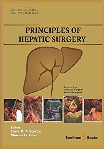 Principles of Hepatic Surgery [Silvio Marcio]