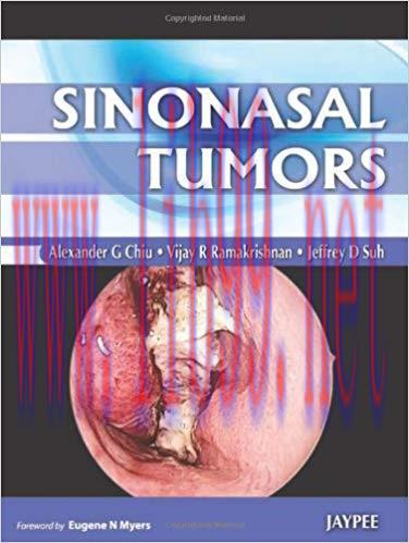[PDF]Sinonasal Tumors [Alexander G. Chiu]