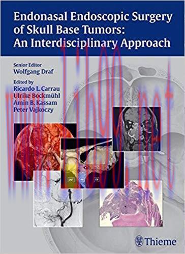 [PDF]Endonasal Endoscopic Surgery of Skull Base Tumors
