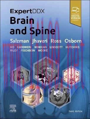 [AME]ExpertDDx: Brain and Spine, 3rd Edition (Original PDF)