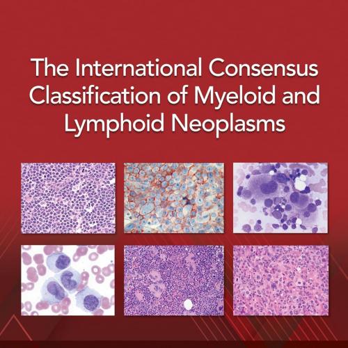 The International Consensus Classification of Myeloid and Lymphoid Neoplasms First Edition