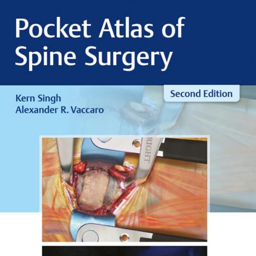Pocket Atlas of Spine Surgery 2nd Edition