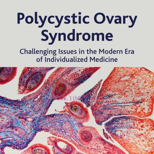 [AME]Polycystic Ovary Syndrome: Challenging Issues in the Modern Era of Individualized Medicine...