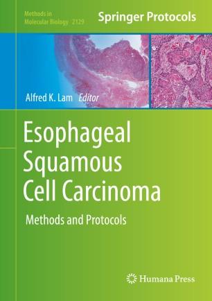Esophageal Squamous Cell Carcinoma