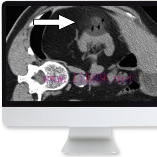 [AME]Cross-Sectional Renal Imaging: Techniques and Diagnosis 2020 (CME VIDEOS)