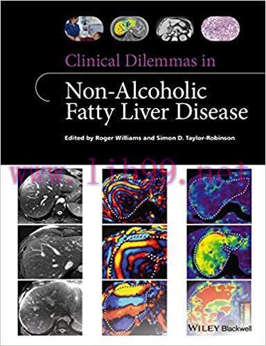 (PDF)Clinical Dilemmas in Non-Alcoholic Fatty Liver Disease (Clinical Dilemmas (UK)) 1st Editio...