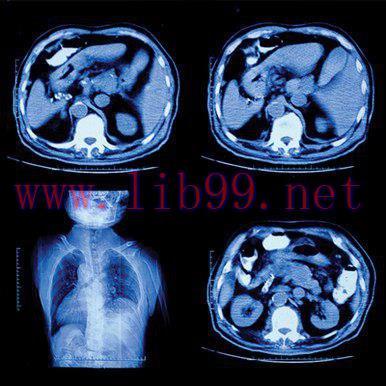 [AME]UCSF Abdominal and Thoracic Imaging 2022 (CME VIDEOS)