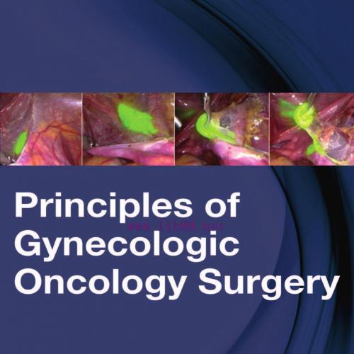 [AME]Principles of Gynecologic Oncology Surgery (ORIGINAL PDF from_ Publisher)