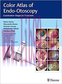 (PDF)Color Atlas of Endo-Otoscopy: Examination-Diagnosis-Treatment 1st Edition