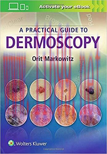 [EPUB]A Practical Guide to Dermoscopy [Orit Markowitz]+PDF