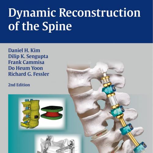 Dynamic Reconstruction of the Spine 2nd Edition - Wei Zhi