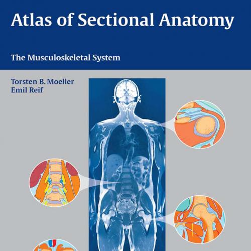 Atlas of Sectional Anatomy The Musculoskeletal System - Moeller, Torsten B.; Emil Reif
