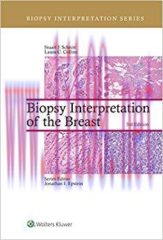 (PDF)Biopsy Interpretation of the Breast (Biopsy Interpretation Series) 3rd Edition
