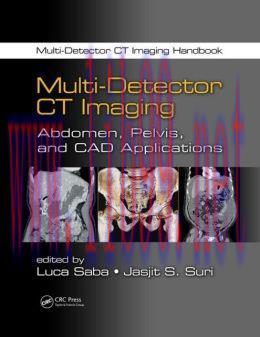 [AME]Multi-Detector CT Imaging: Abdomen, Pelvis, and CAD Applications (ORIGINAL PDF from_ Publi...